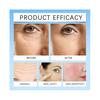 Repair Facial Redness Serum Instant Spider Vein Remove Sensitive Skin Sooth Anti Redness Rosacea Treat Lotion Korean Cosmetics