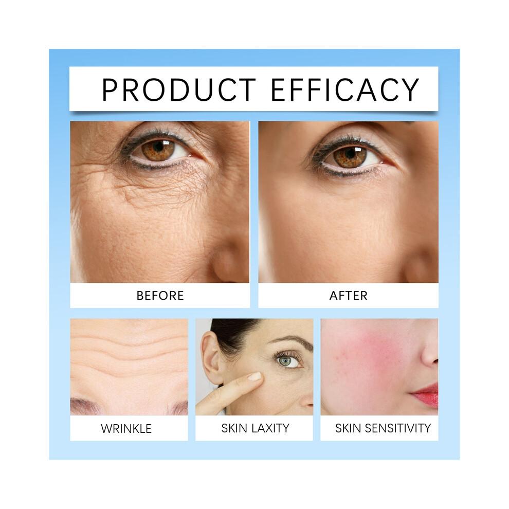Repair Facial Redness Serum Instant Spider Vein Remove Sensitive Skin Sooth Anti Redness Rosacea Treat Lotion Korean Cosmetics