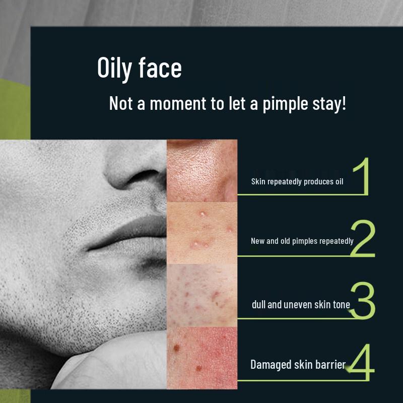 Mentholatum Oil Control Anti-Akne Reinigungsschaum