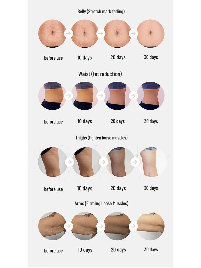 4-in-1 Skin Rejuvenation Device: Body Slimming, Infrared Fat Burning, Firming, Lifting & EMS Microcurrent RF Radiofrequency