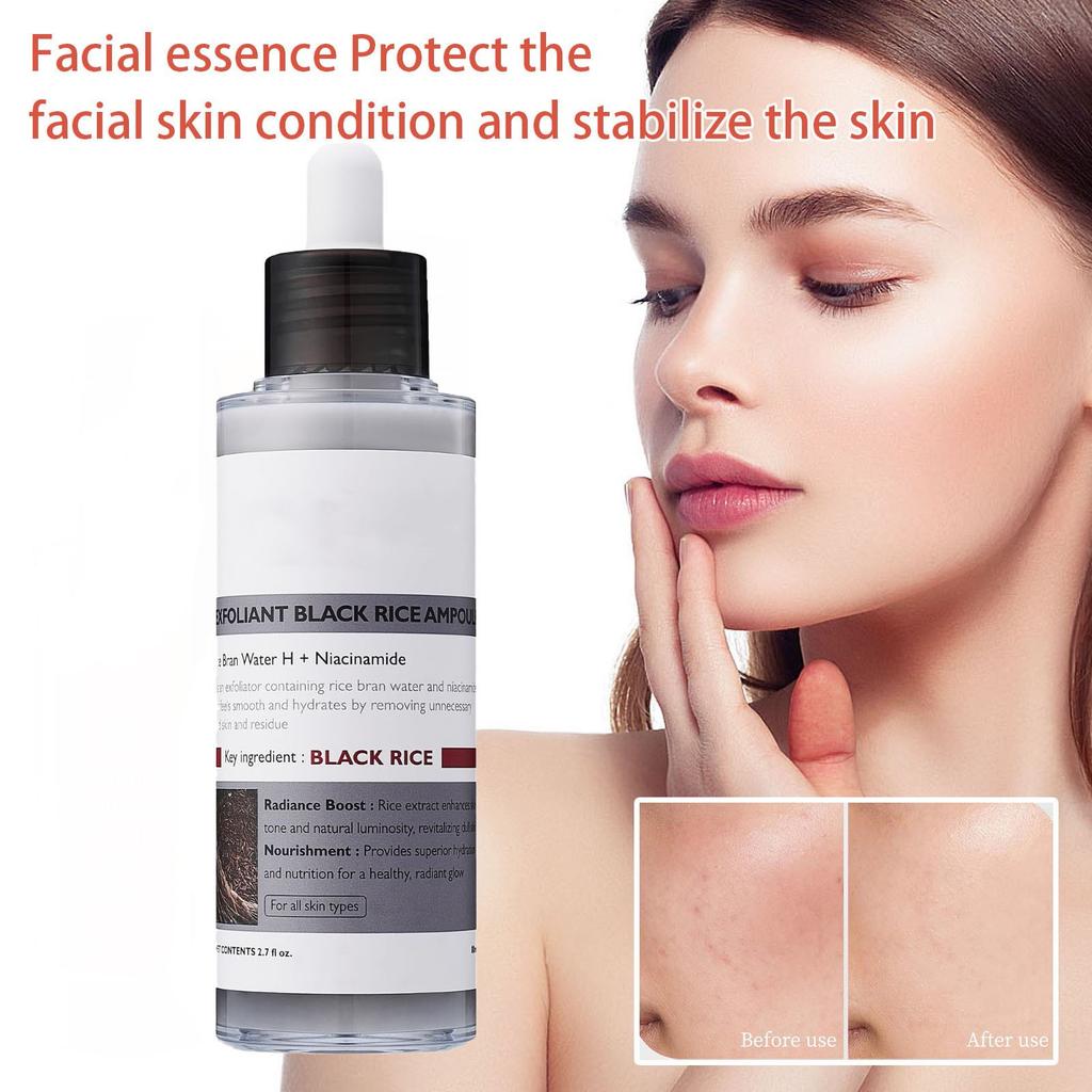 Black Rice Exfoliator Gentle Exfoliator For Face And Body To Remove Dead Skin Cells And Blackheads 80ml