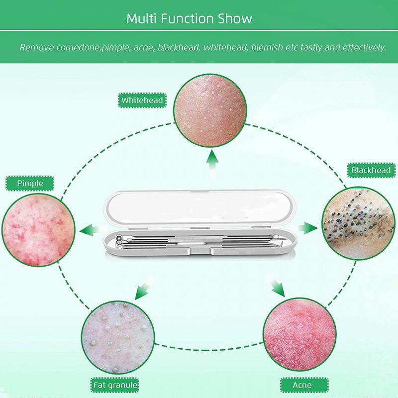 5Pcs Blackhead Remover Comedone Extractor, Curved Blackhead Tweezers Kit, Professional Stainless Pimple Acne Blemish Removal Too