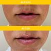 L Occitane Ultra Reichhaltiger Sheabutter Lippenbalsam 0,39 Unzen   12 ml