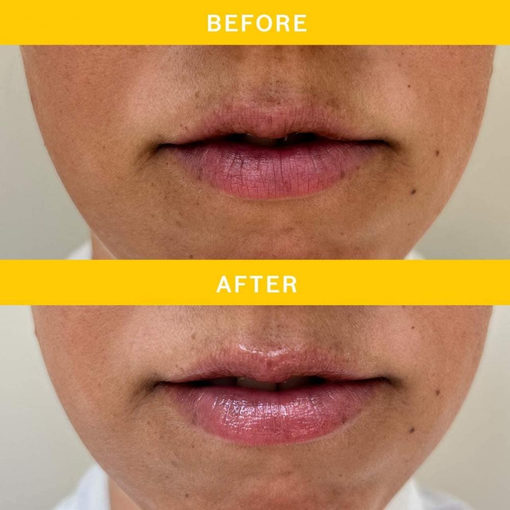 L Occitane Ultra Reichhaltiger Sheabutter Lippenbalsam 0,39 Unzen   12 ml