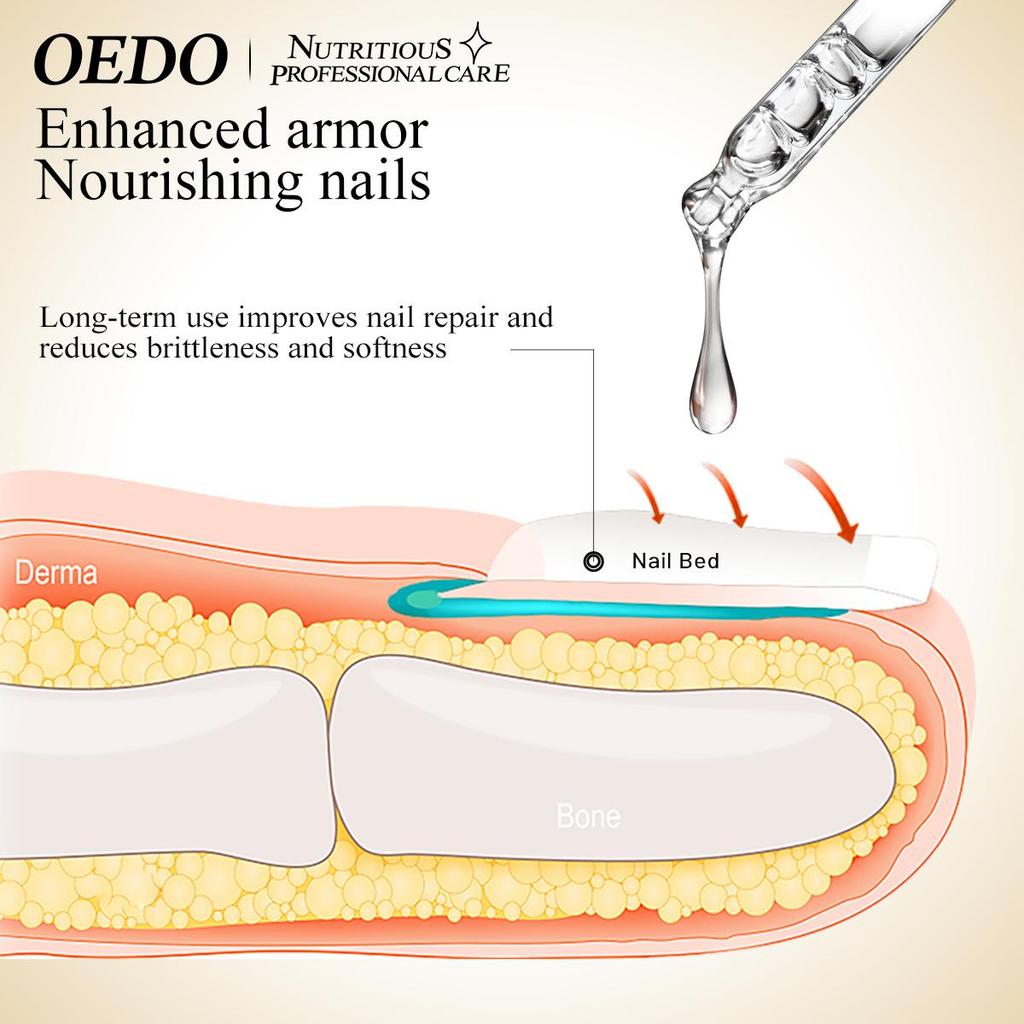 OEDO Herbal Nail Treatment Essential Oil Hand and Foot Whitening Toe Nail Removal Feet Care Polish Nail Gel Nail Repair Treatment