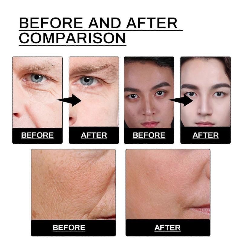 Men's Anti-wrinkle Essence Anti-wrinkle and Smooth Lines Firming Skin Restore