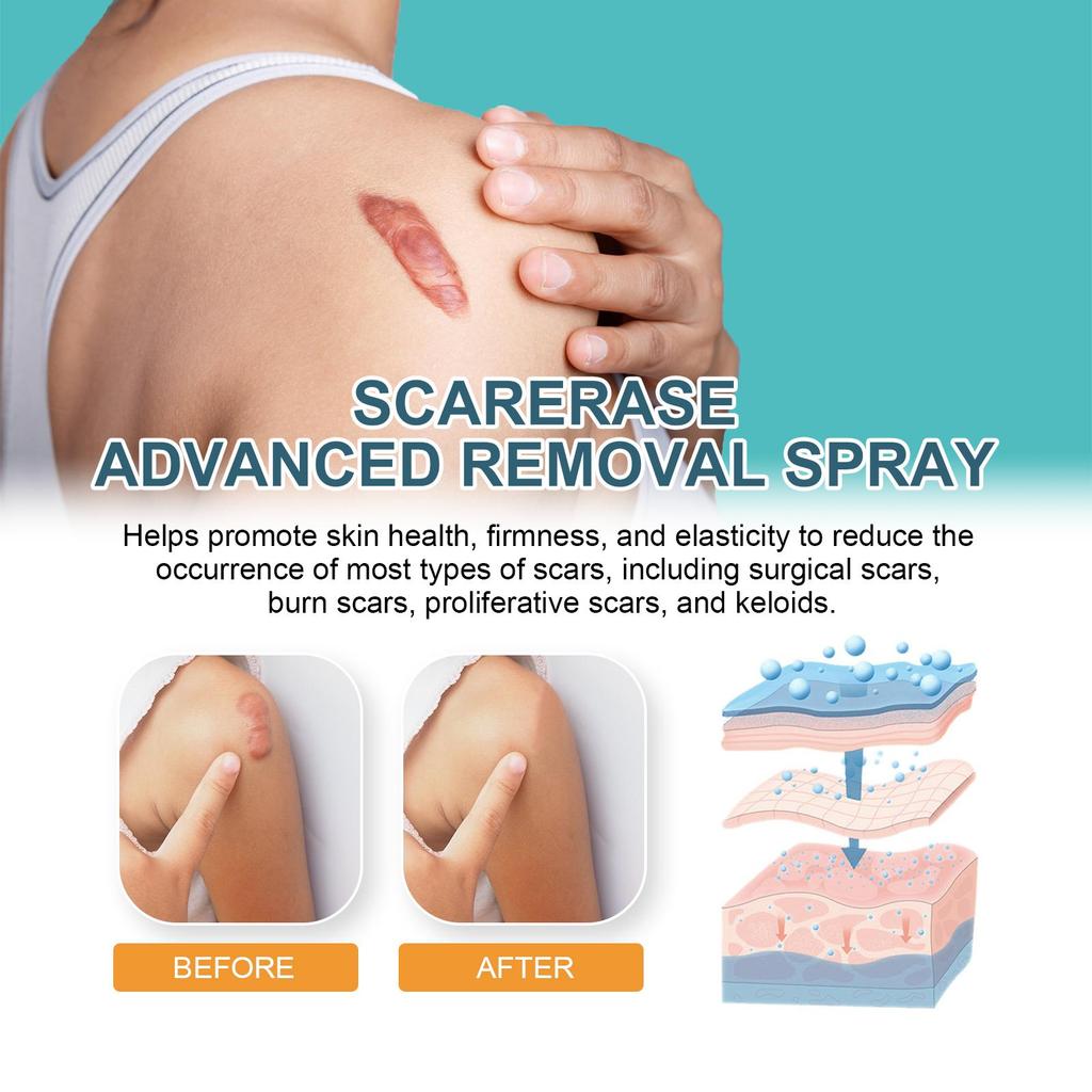 20g West&Month Scar Repair Gel Scar Lightening Moisturizing Skin Repair Smoothing Skin Gel