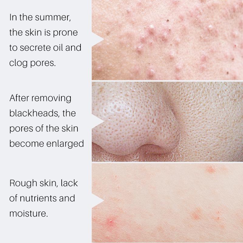 Bose Anti-wrinkle Essence Anti-aging Firming Desalination Fine Lines Brightening Moisturizing