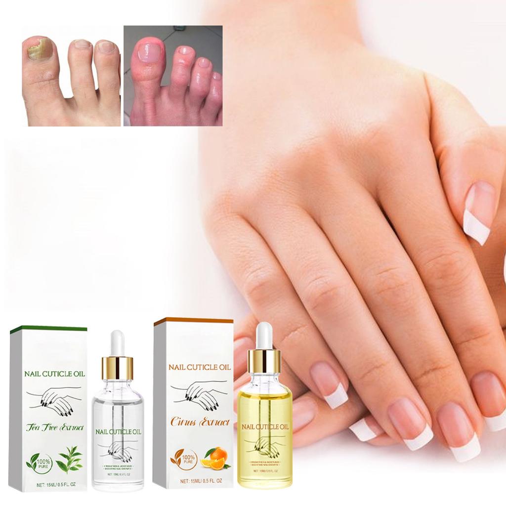 15ml Nail Strengthening Cuticle Oil, Nail Care Moisturizing And Brightening Nails, Care Oil