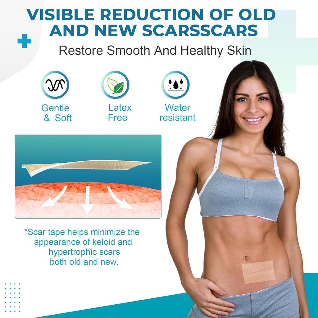 Silicone Scar Tape Reusable Sheet Scars Burns Tummy Chin Keloid Medi Grade for C-section - Cut To Size, 60 Inch