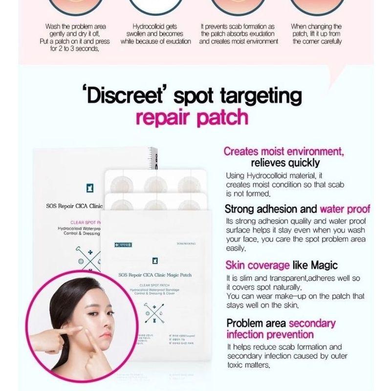 TOSOWOONG - SOS Repair Cica Clinic Acne Patch 66pcs