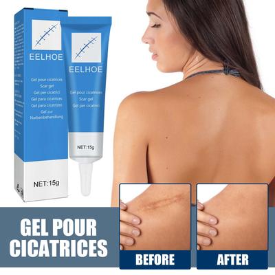 Scar Removal Cream Gel Remove Acne Spots Treatment Stretch Marks Burn Scar Repair Cream Smoothing Whitening Skin Beauty