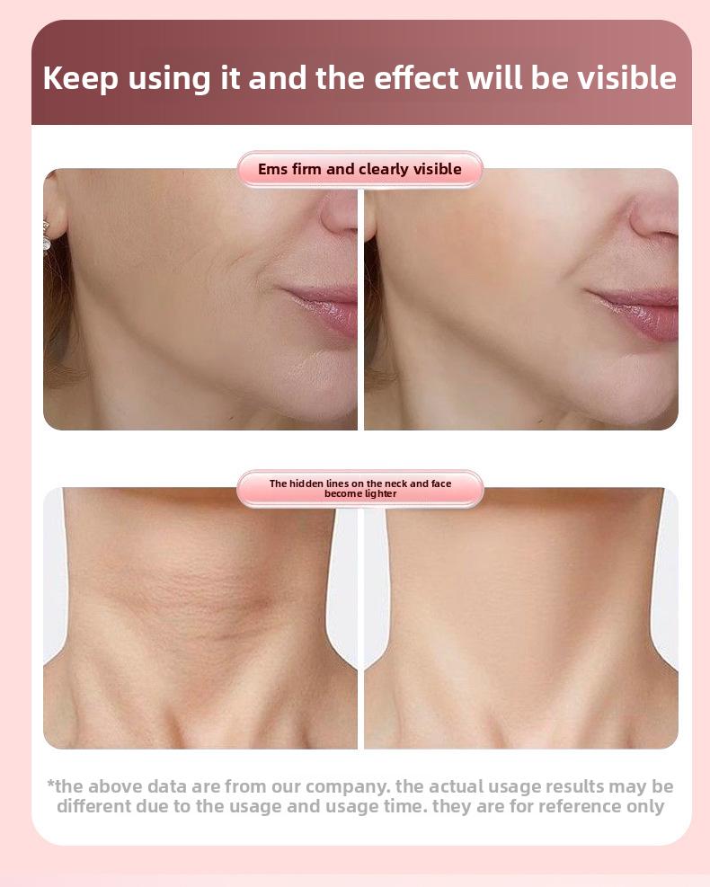 EMS Microcurrent Roller Face-Slimming Artifact V-Face Beauty Facial Massager For Firming And Lifting The Face