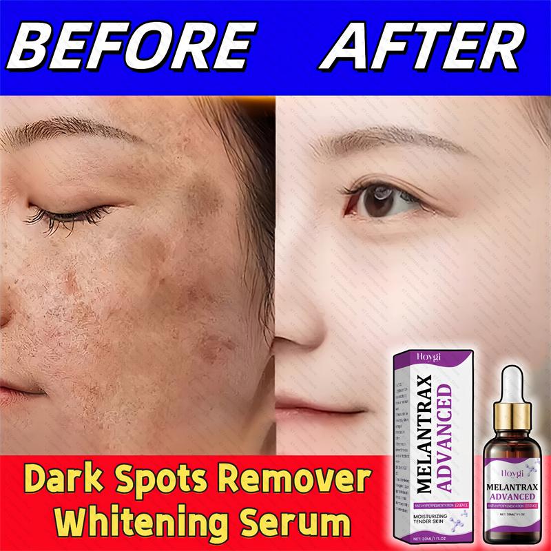 Sérum Blanchissant Anti-Taches Pigmentaires Correcteur de Mélanine Visage Taches de Rousseur Éclaircissant Beauté Soin de la Peau Coréen Jour Nuit
