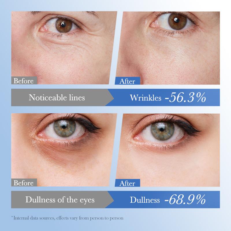 Crema para Ojos Niacinamida Arroz Blanco Anti Ojeras Elimina Bolsas Iluminadora Hidratante Reafirmante Cuidado de la Piel de los Ojos