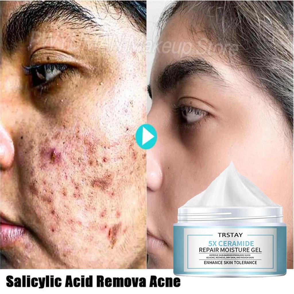 Retinol Moisturizing Face Cream, Mild and Non Irritating, Moisturizes, Brightens Skin Tone, and Makes Skin Soft and Delicate