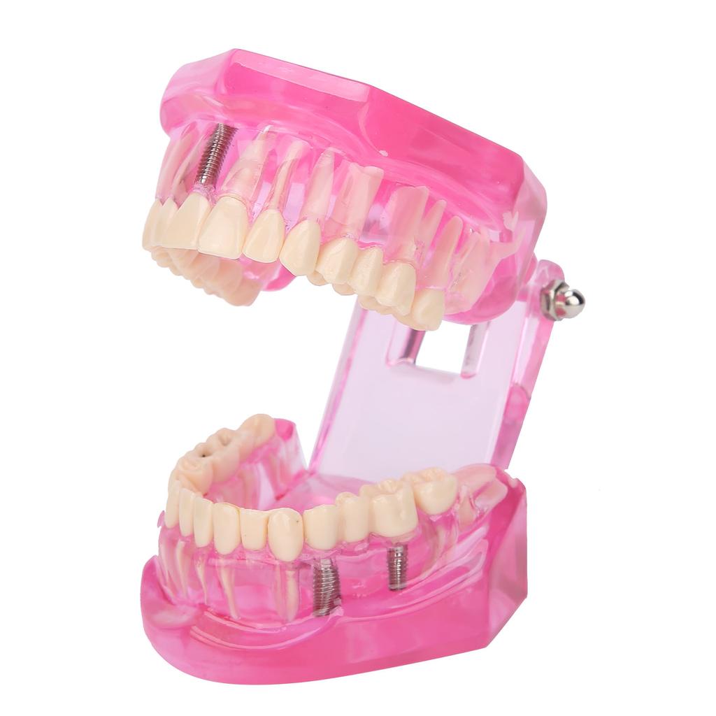 Model de dinți adulți transparenti, reparații patologice, studiind instrumente didactice dentare