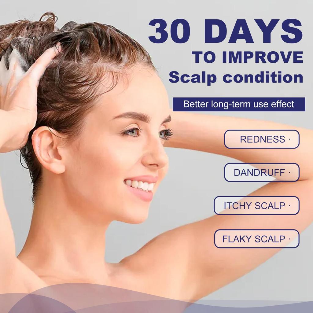 Hoegoa folliculitis shampoo, anti-hair loss, deep cleansing, strong hair, solid hair, dense hair care shampoo