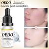 Fuktighetsgivende Anti-rynke Ansiktsserum med Oligopeptid Kamille Anti-aldringsessens Bleking Lysner Nærer Hudpleie 10ml
