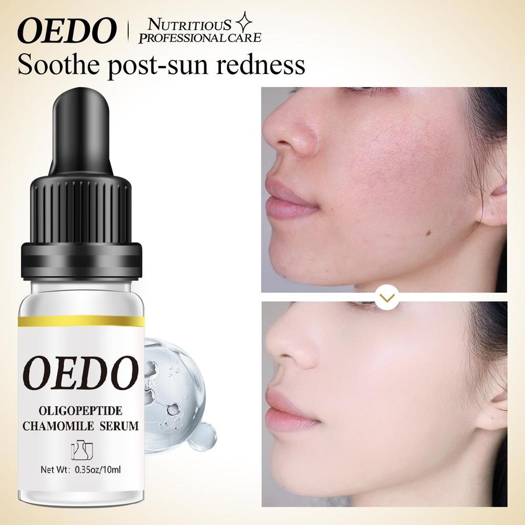 Fuktighetsgivende Anti-rynke Ansiktsserum med Oligopeptid Kamille Anti-aldringsessens Bleking Lysner Nærer Hudpleie 10ml