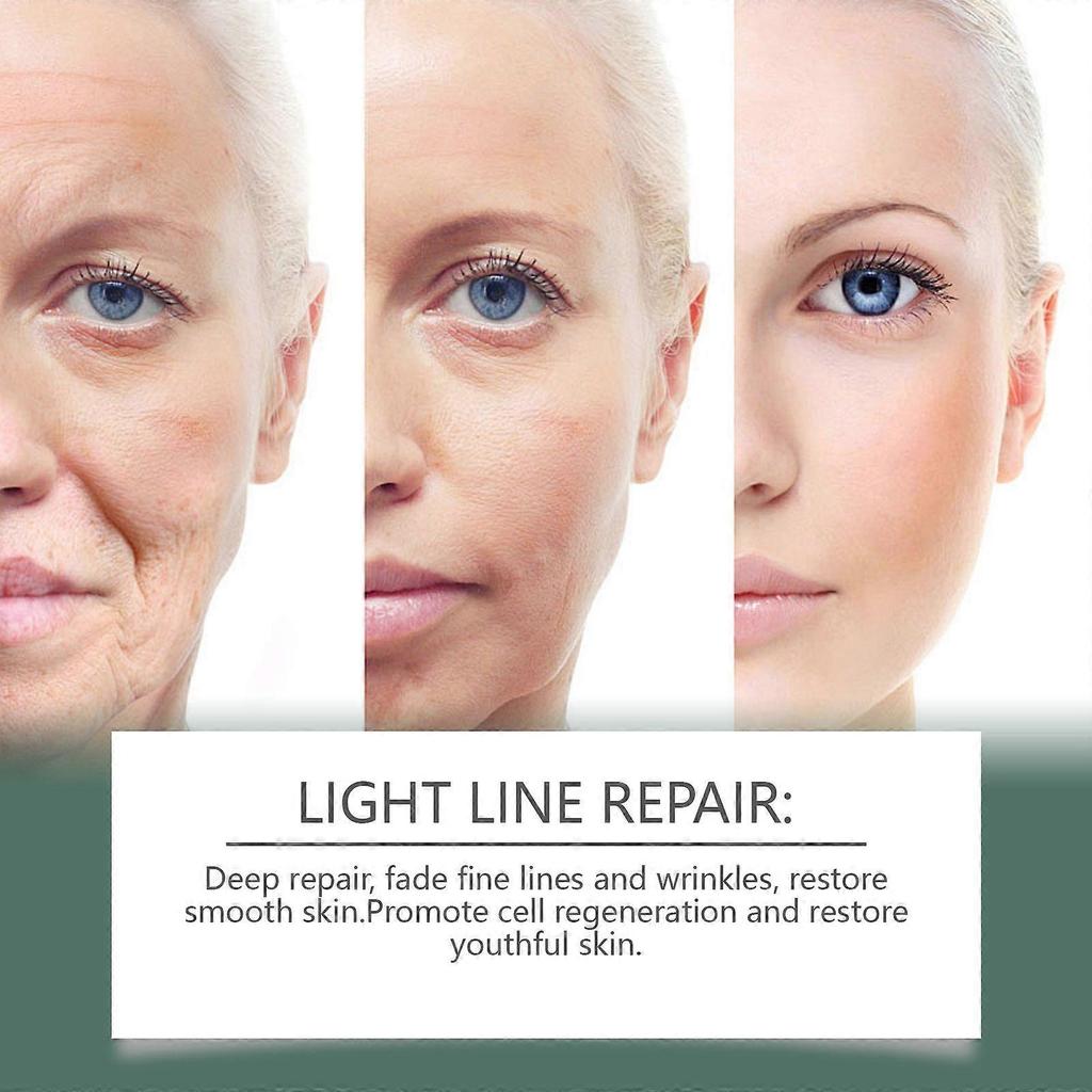 Limited time!!Ouhoe Facial Essence Moisturizes, Hydrates, Hydrates And Brightens The Skin, Providing Gentle Care For The Facial Skin