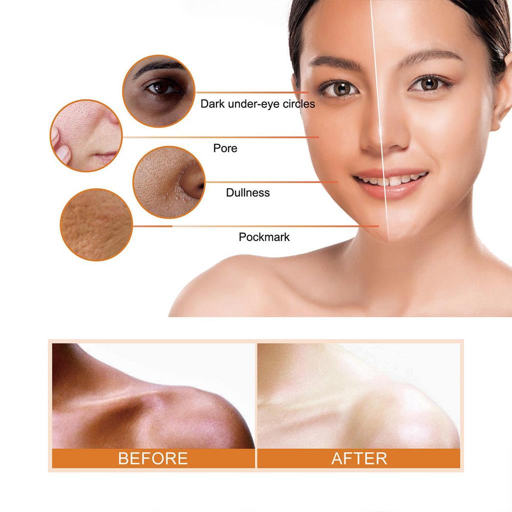 Moisturizing Cream, Moisturizing, Brightening the Complexion, Leaving the Skin Soft and Delicate, Gentle and Non-irritating