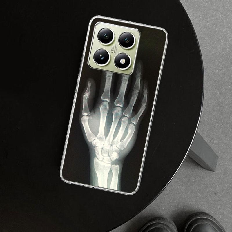 Autumu X Ray Hand Bones Phone Case Cover for Xiaomi Redmi Note 15 14 13 12 11 Pro Plus 14S 12S 11S 11T 11E 10S 10 Customized Fun