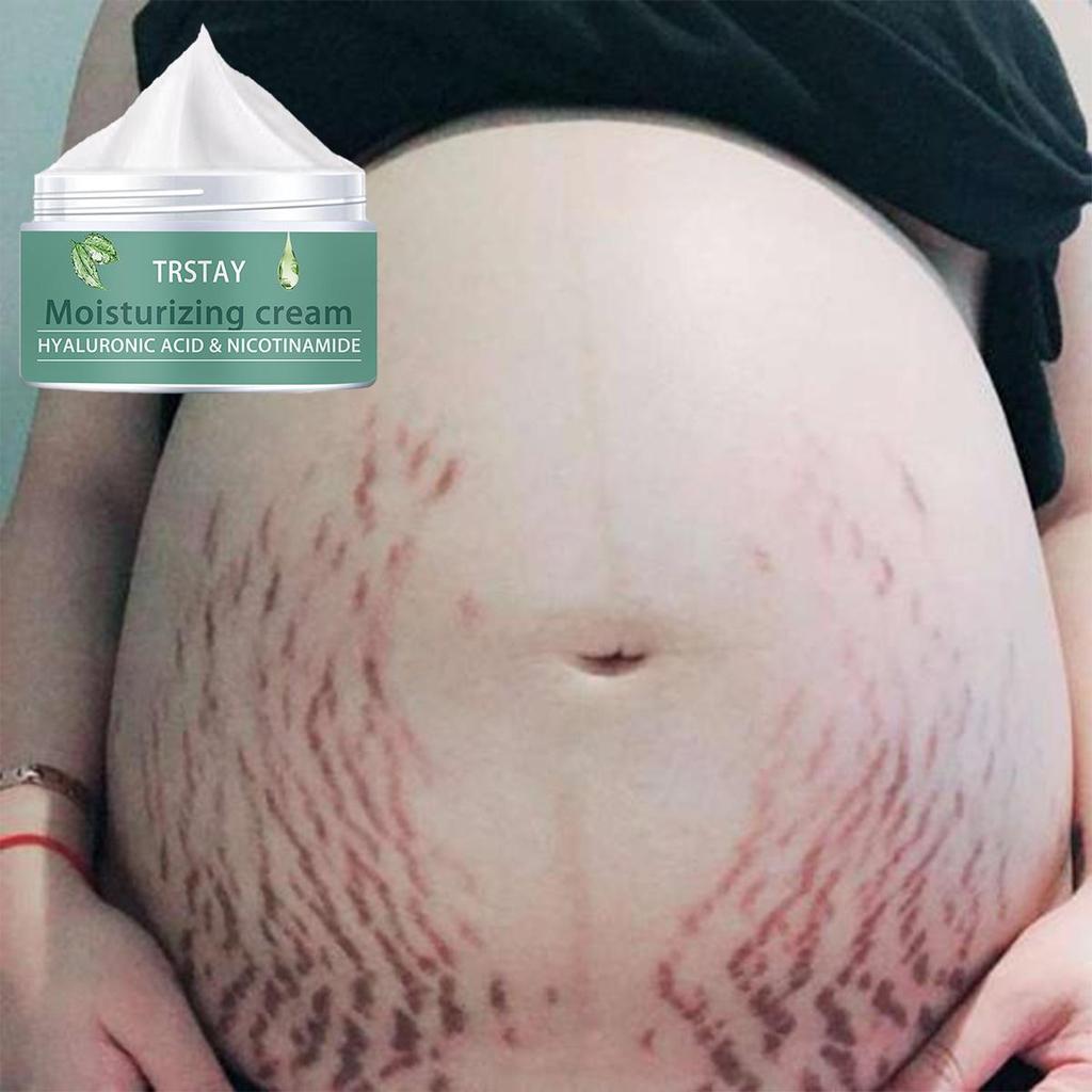 Těhotná žena strie Repair Cream Poporodní opravy a vyblednutí strií