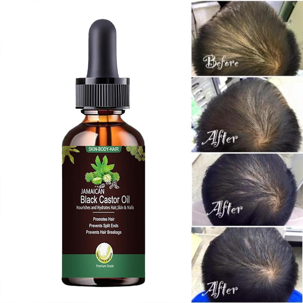 Rice Fermented Hair Growth Oil Essence Hair Oils Growth Serum Rich Nourishing Ingredients Promotes Thicker Stronger