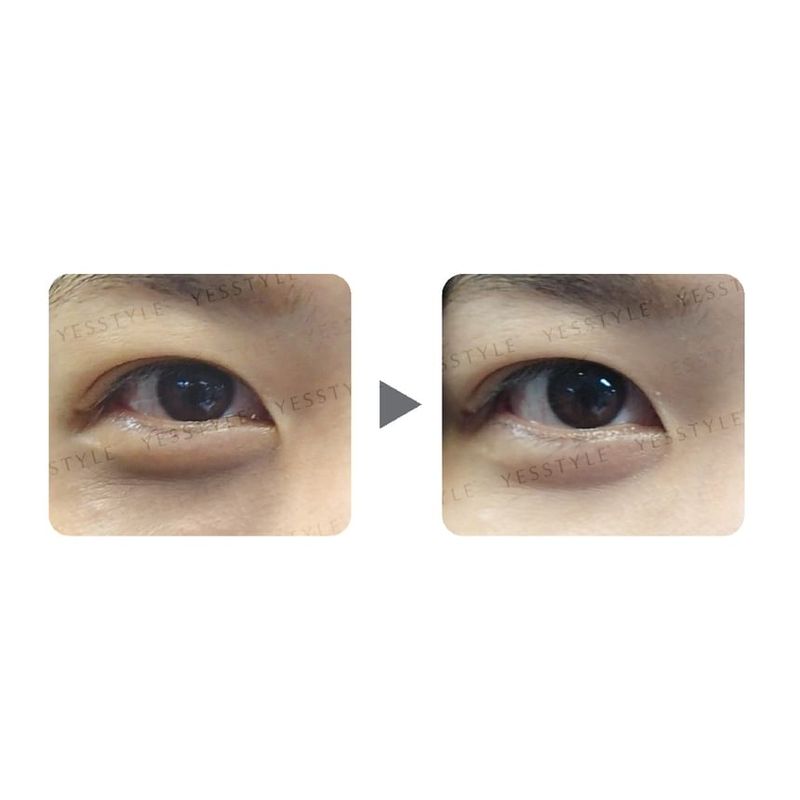 Zino - Dark Circle Removal Golden Eye Mask