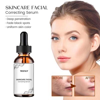 Effective Whitening Freckle Cream Remove Dark Spot Face Cream Removal  Melasma Lighten Brighten Smooth Skin Care