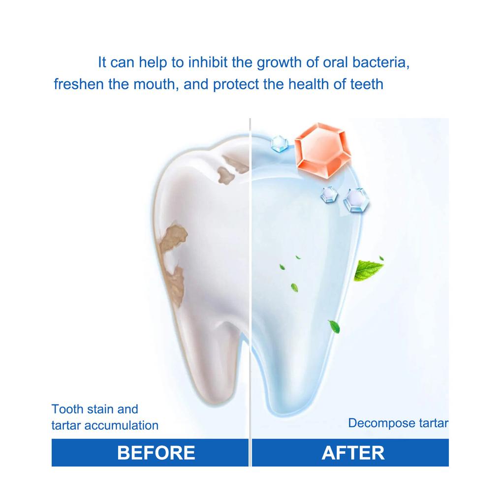 SP Probiotic Toothpaste Whiten Toothpaste Clean Mouth Stain Remove Fresh Breath Soft Foam Protect Gum Whiten Teeth Oral Care