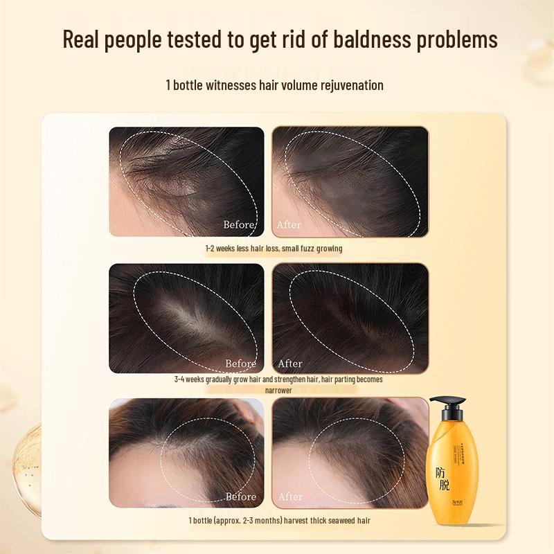Taomijiang Anti-Hair Loss & Oil Control Shampoo