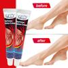 Anti-swelling Cream Foot Pain Cream Legs