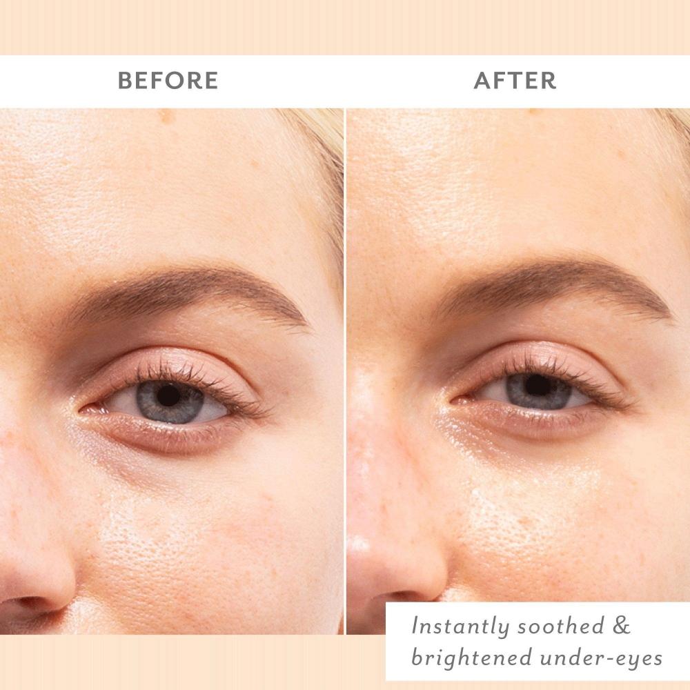 Patchology Skin Remedy Soothing Eye Gels 5 Pair