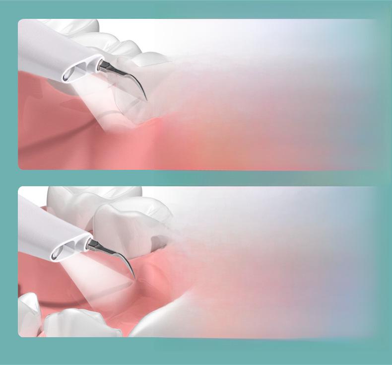 Ultrasonic Pet Electric Tooth Cleaner for Tartar Removal and Oral Care