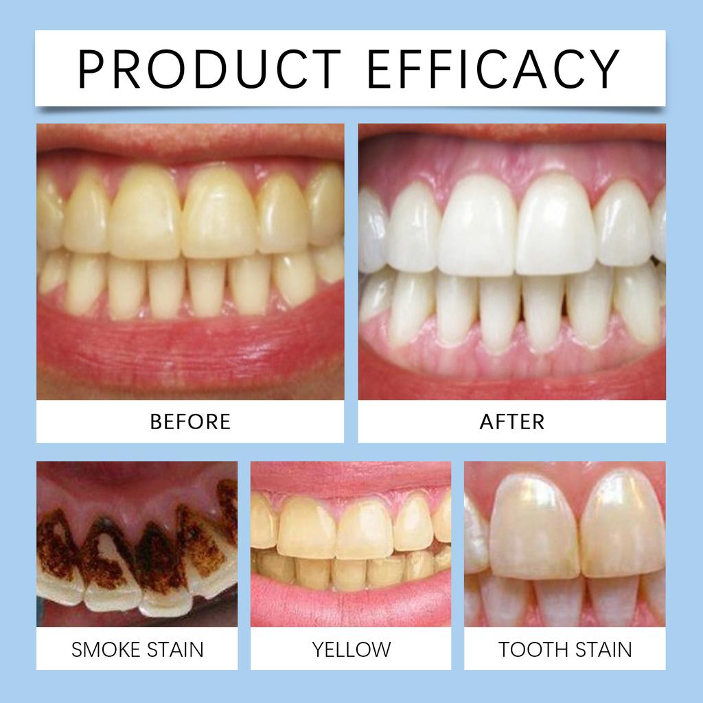 Mint Scent Toothpaste Tablets Oral Refresh Remove Tea and Coffee Stains Prevent Decay Promote Dental Toothpaste Tablets