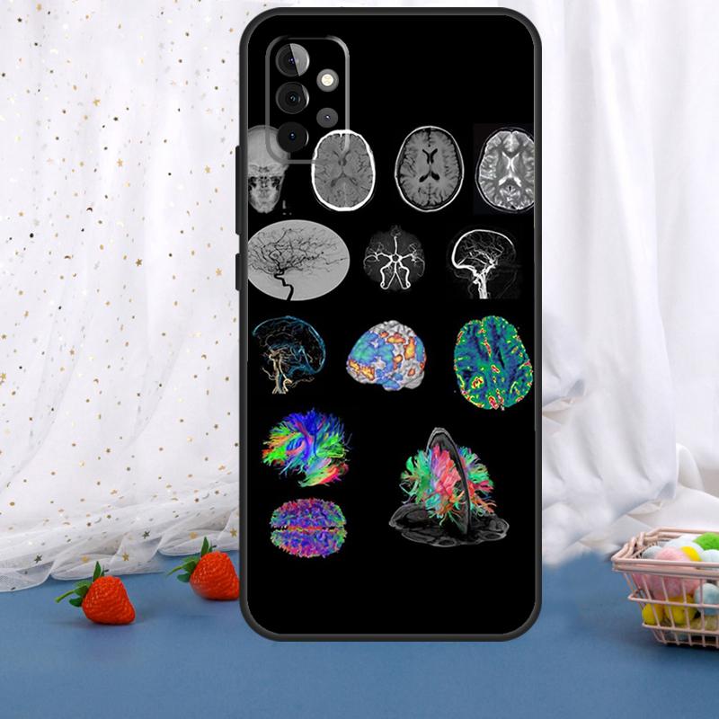 Anatomy Brain For Samsung Galaxy A55 A35 A05 A52 A32 A22 A54 A14 A16 A26 A36 A56 A06 A15 A53 A33 A13 Case