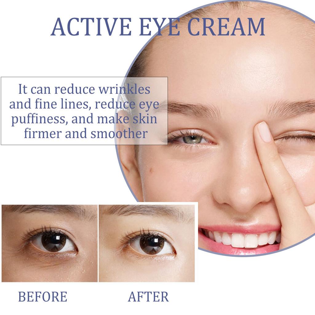 Eelhoe Firming Eye Cream For Dark Circles And Fine Lines With Skin Repair Properties 30ml