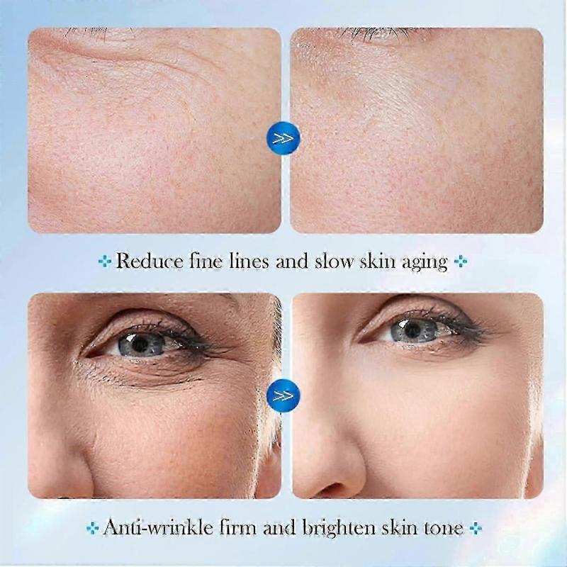 Hyaluronic Acid Serum Microneedling Serum For Face, Hyaluronic Acid Anti-aging Repair Serum, Ceramide Ampoule Serum with Hyaluronic Acid