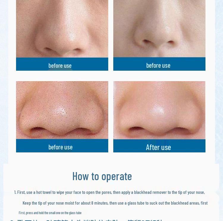 Multi-functional Blackhead Remover and Pore Cleaner with Gua Sha