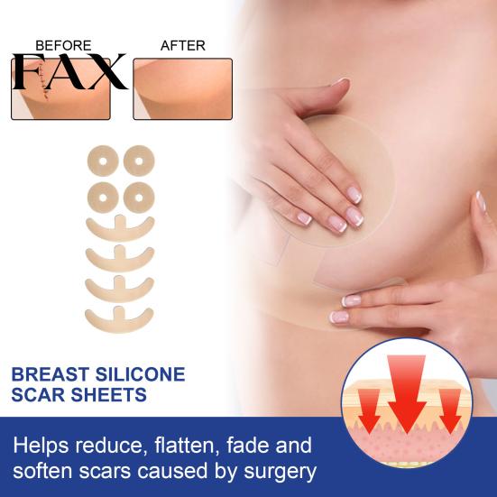 Plaster 4 Pairs Breast Scar Patch Comfortable Irritation-free Ultra-Thin Lightweight Repair Fading Smoothing Surgery Skin Sticker for Girl High