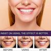 3x 7-Pro Intensive Toothpaste, 7PRO Intense Whitening Toothpaste with 7 Probiotics