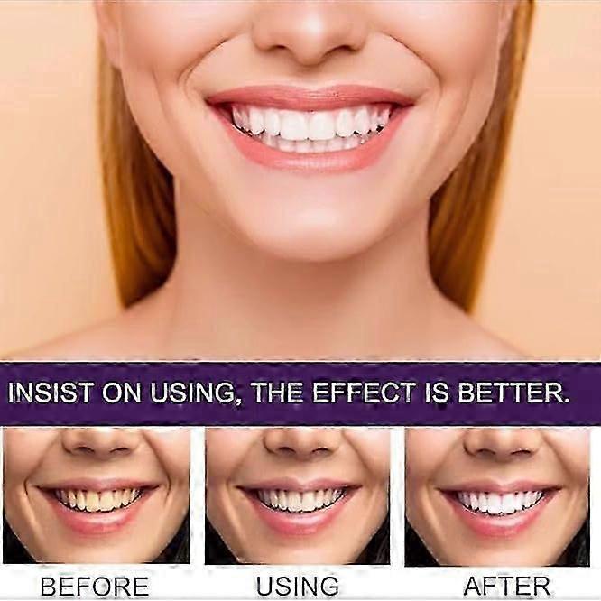 3x 7-Pro Intensive Toothpaste, 7PRO Intense Whitening Toothpaste with 7 Probiotics
