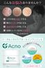 Acne Care Acne Scar Relief Cream Gel Medicated Acno for Adult and 50g Made in [Doctor-Supervised] All-in-One Quasi-Drug Acne, Back, Buttocks,