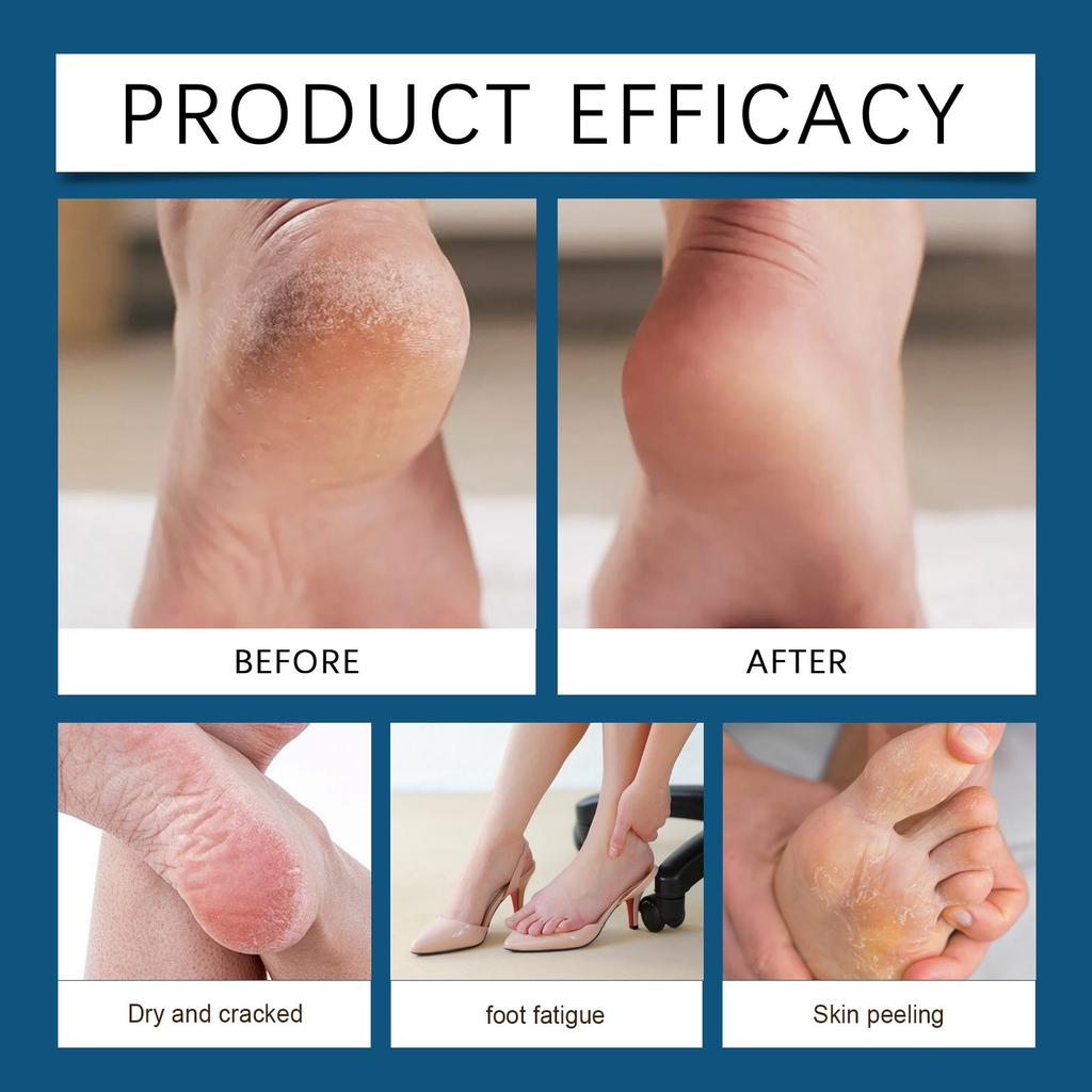 Foot Care Cream Gentle Care And Nourishment Of Foot Skin Comfortable Massage External Foot Cream