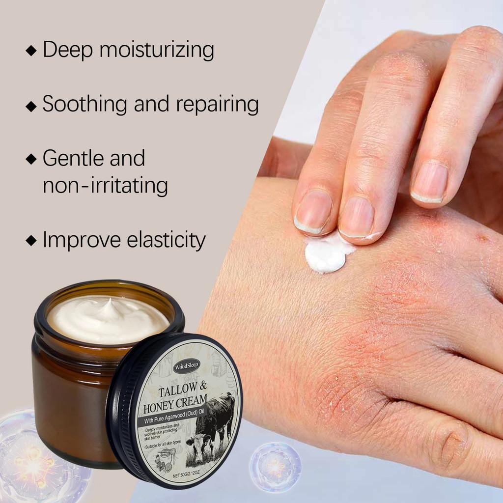 Woodsleep Moisturizing Body Cream With Beef Tallow For Deep Hydration And Skin Relief