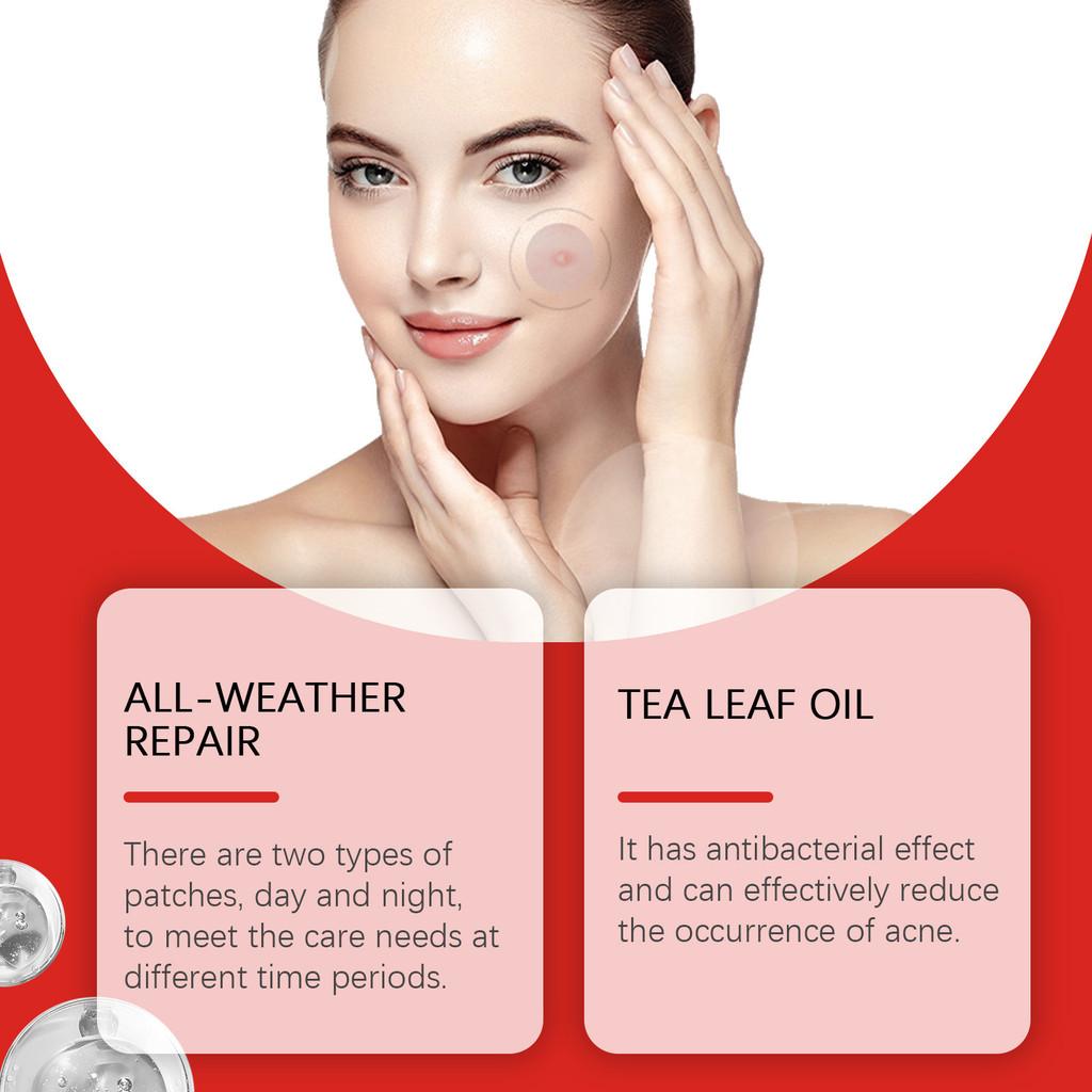 Jaysuing Acne Cover Patches For Face Skin Soothing Healing And Pimple Relief With 288 Durable Patches