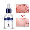 15ML Gesicht Nährendes Serum Hyaluronsäure Essenz Hautpflege Tiefe Gesichts Anti Aging Intensive Face Lifting Straffende