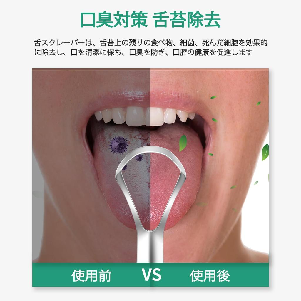 RONAVO Tongue Brush [Double Color for Different Uses] Tongue Cleaner (Stainless Steel)  Tongue Polishing  Tongue Coating Removal  Gentle and Hygienic